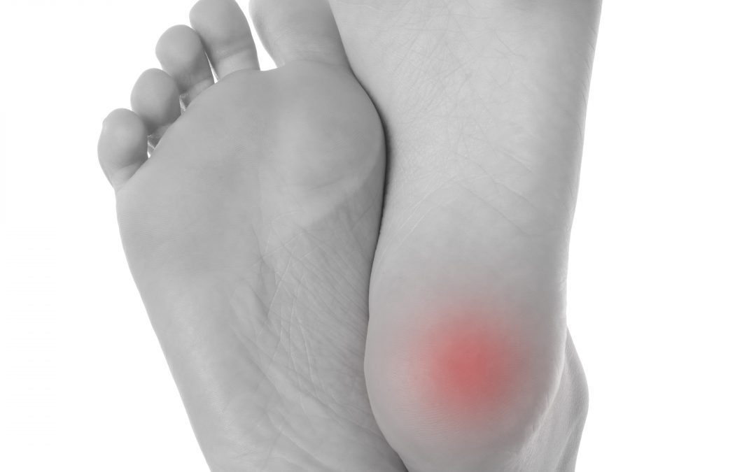 The Morning Pain Phenomena