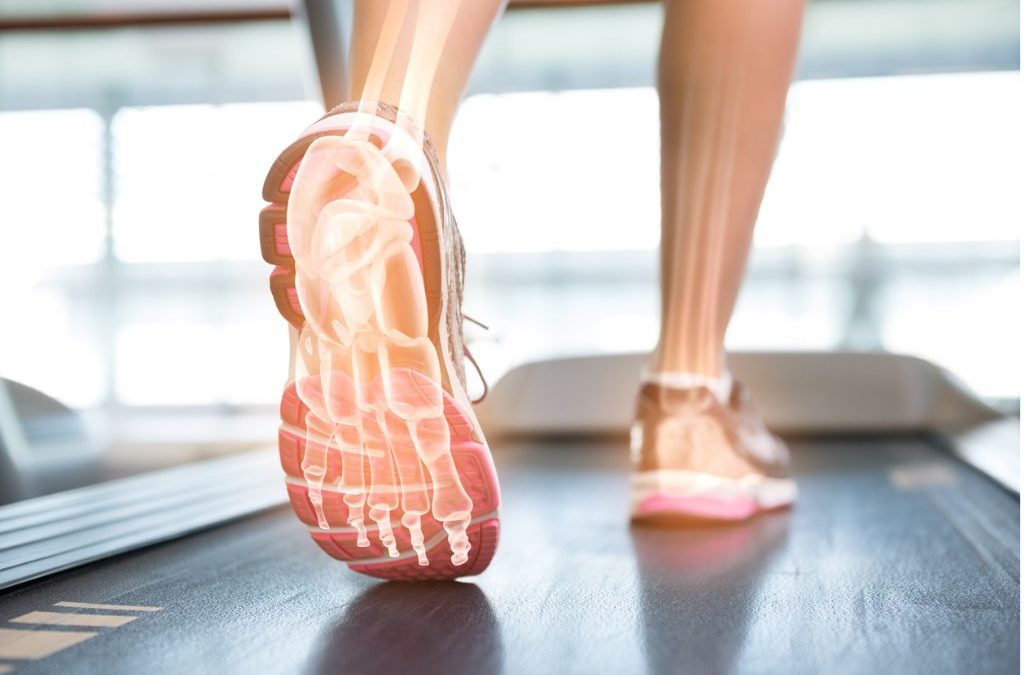 Does The Way I Walk Cause My Heel Pain?