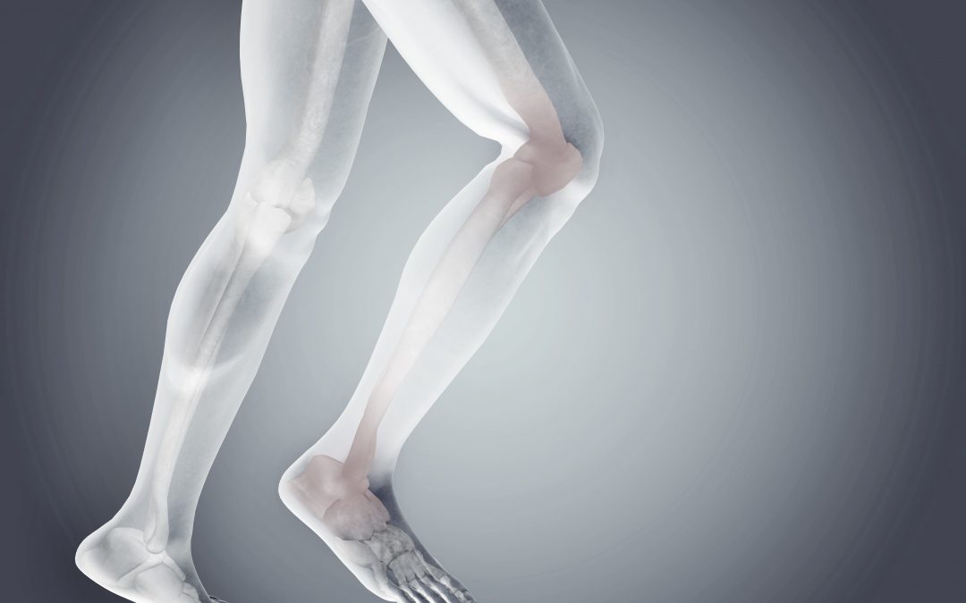 Why My Shins Hurt When I Run