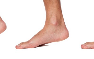 Do Orthotics Weaken Your Feet?