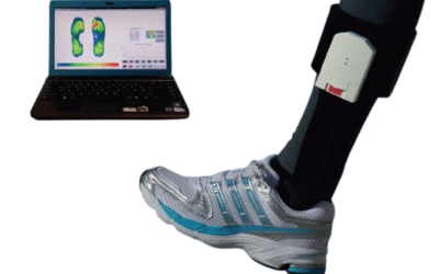 A Smarter Way To Prevent Diabetic Foot Ulcers