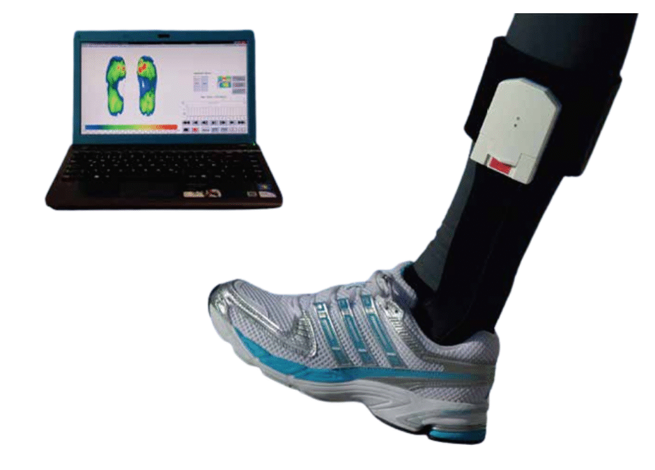 A Smarter Way To Prevent Diabetic Foot Ulcers