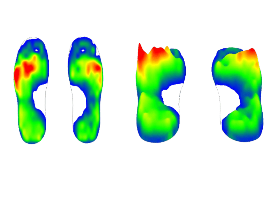 Real Time Foot Pressure Mapping