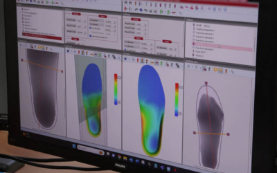 How Your Custom Orthotics Are Made
